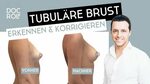 Habe ich eine TUBULÄRE BRUST- Dr. Rolf Bartsch - YouTube